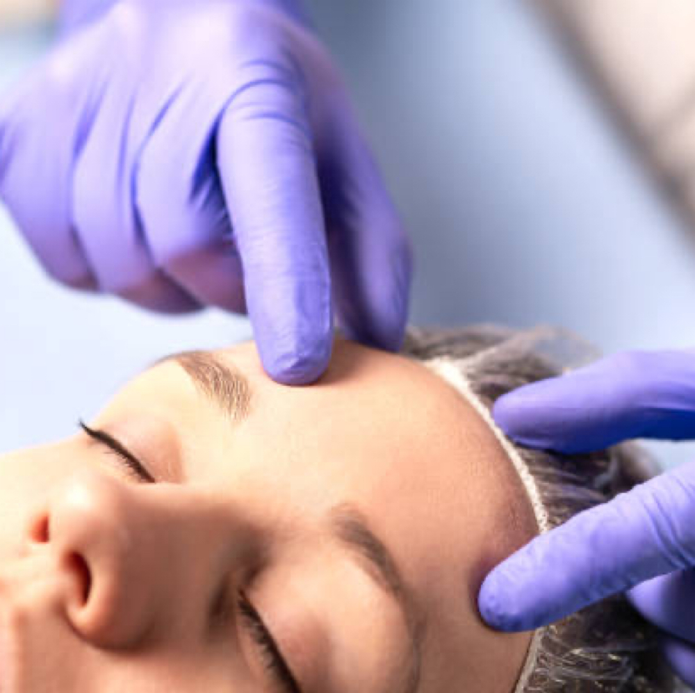 SKIN CONSULTATION TREATMENT at Simply Skin clinical skin care in Westport, CT