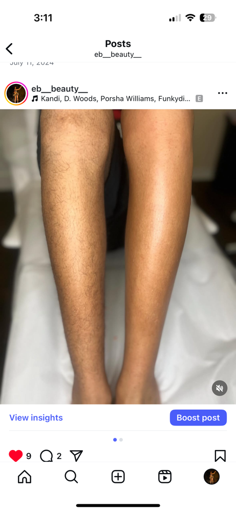 Legs (lower)