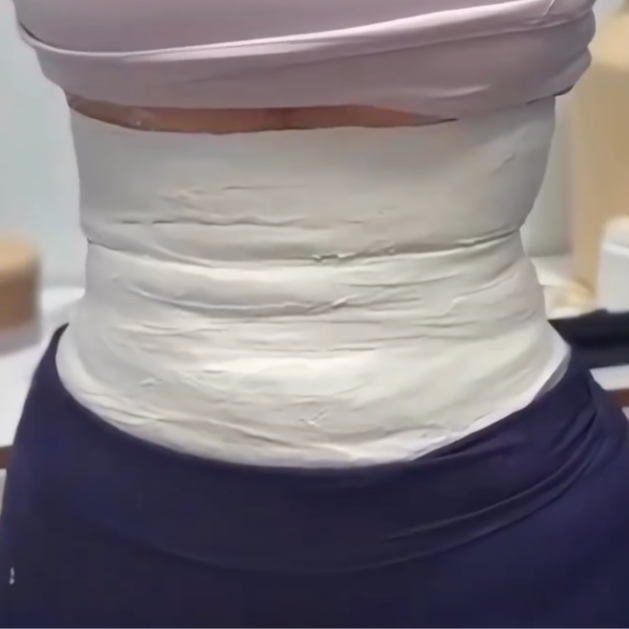 Contour Cast Wrap at CurvSculpt in Denver, CO
