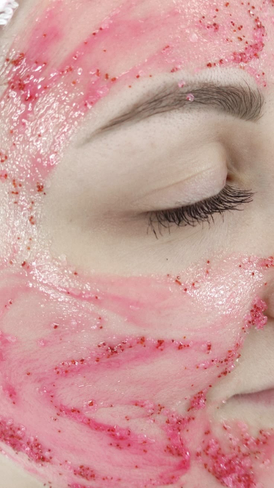 Chemical Peel