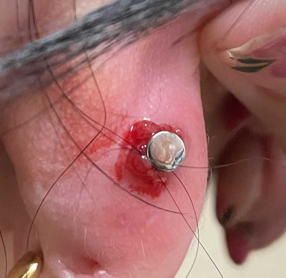 Troubleshoot Existing Piercing