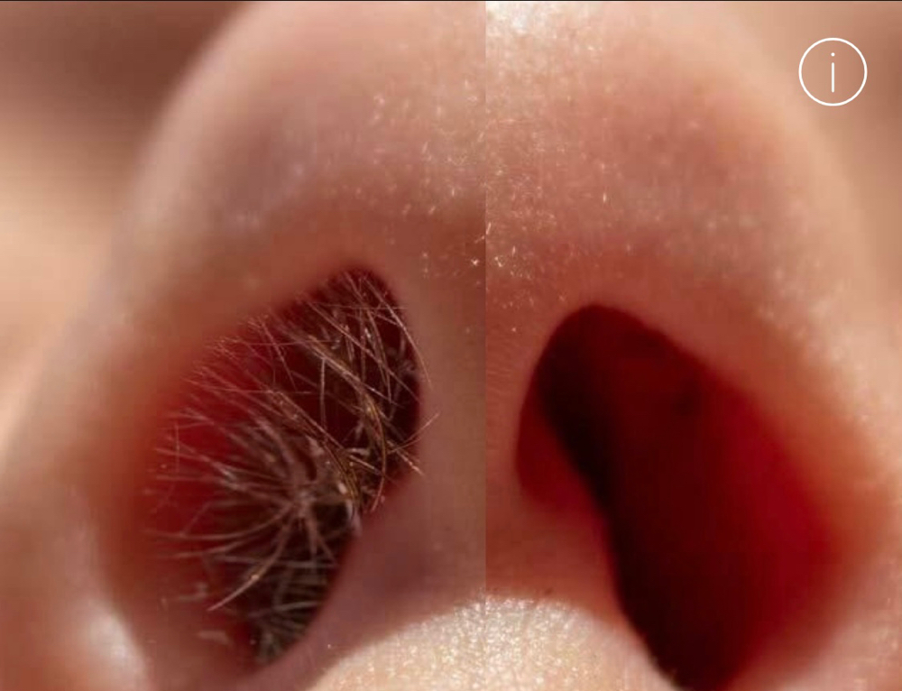 Nose