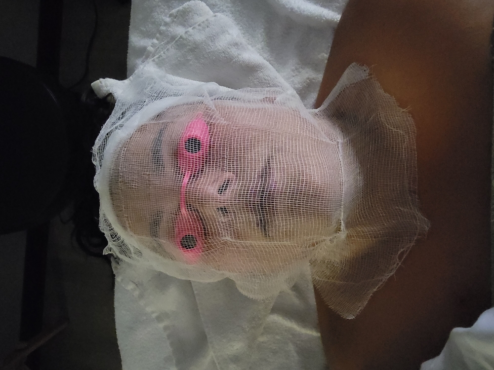 Clarifying Facial