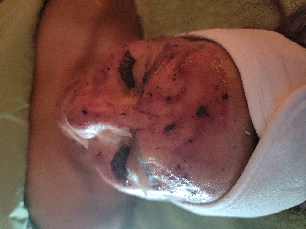 Blueberry Facial
