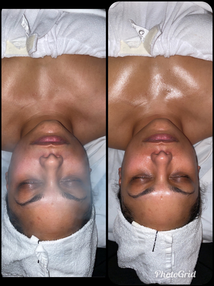 Glow Baby Facial