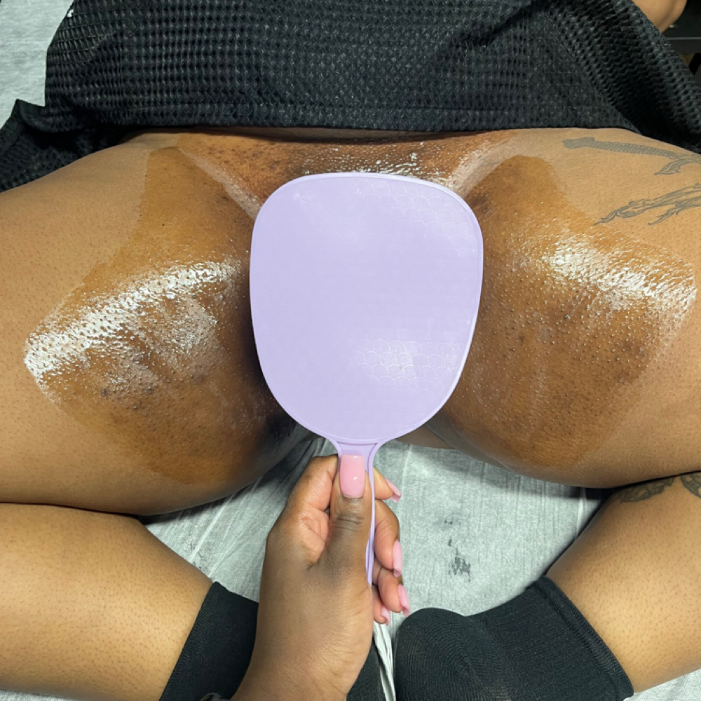 Chemical Peel at Beyond the Body Studio in Columbia, SC