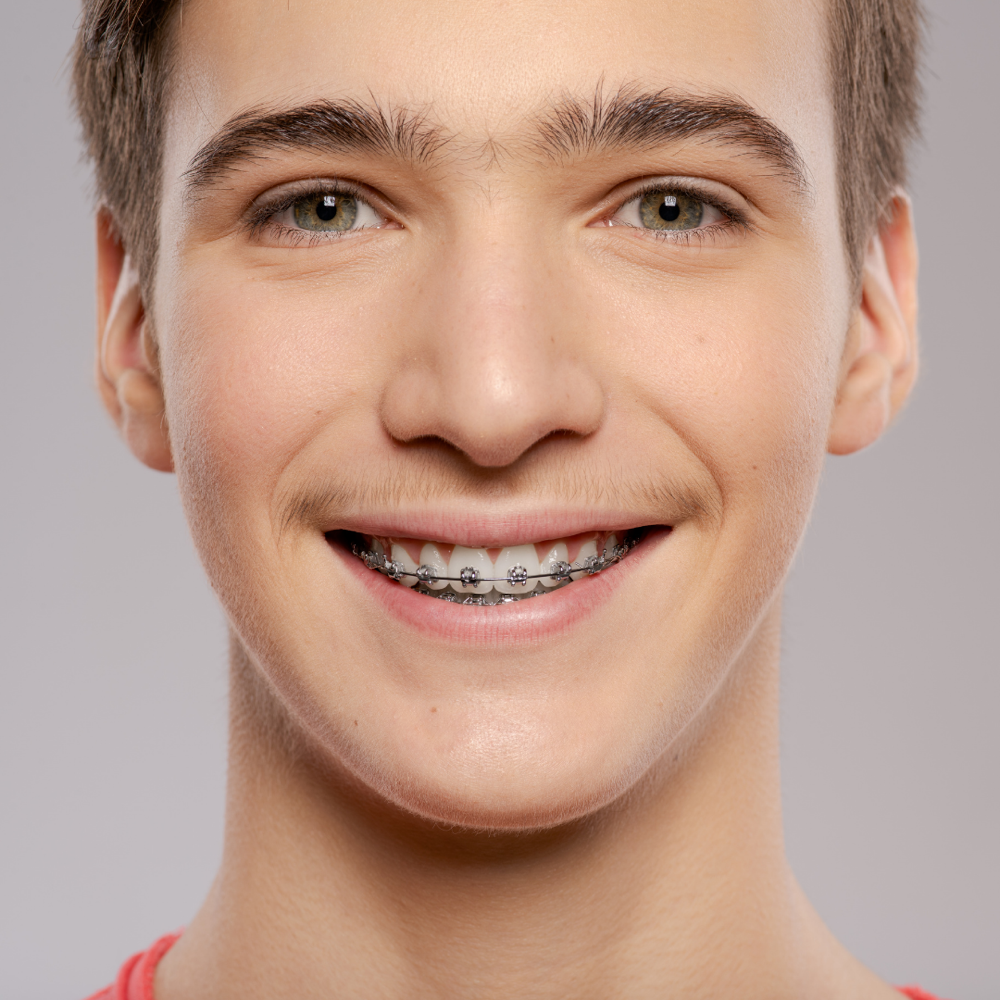 Teen facial