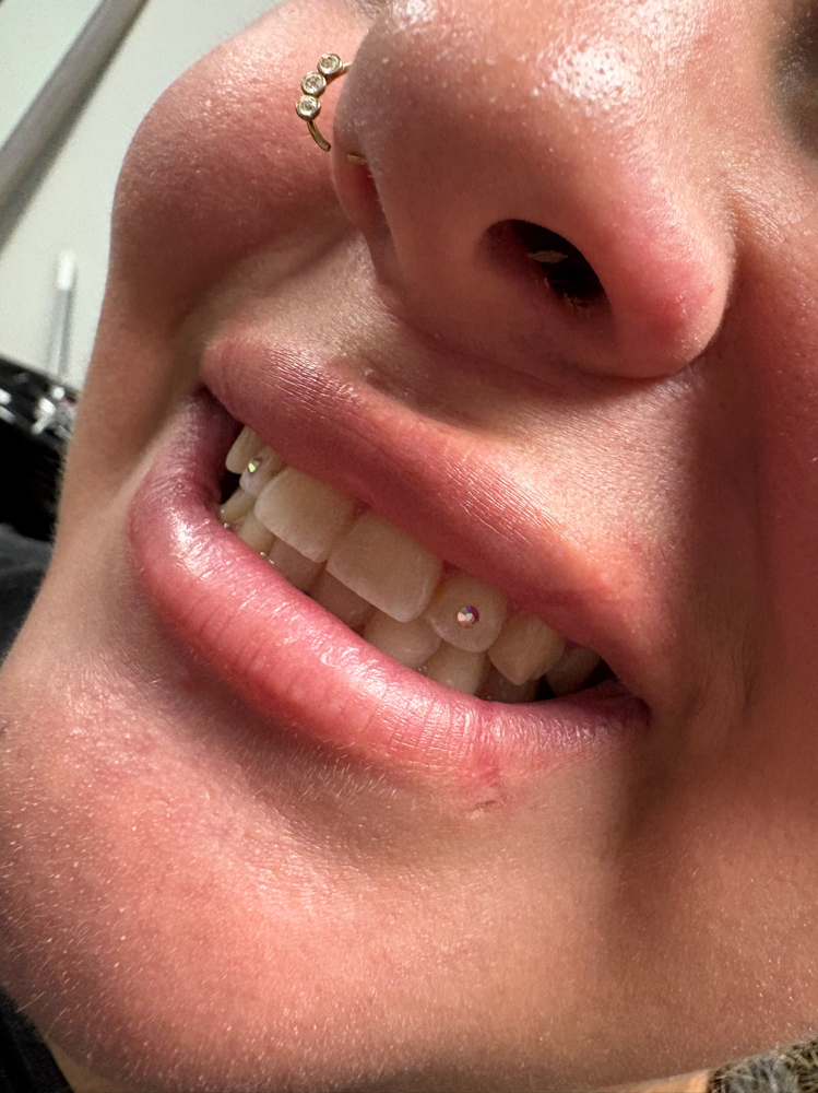 (swarovski) Tooth Gem