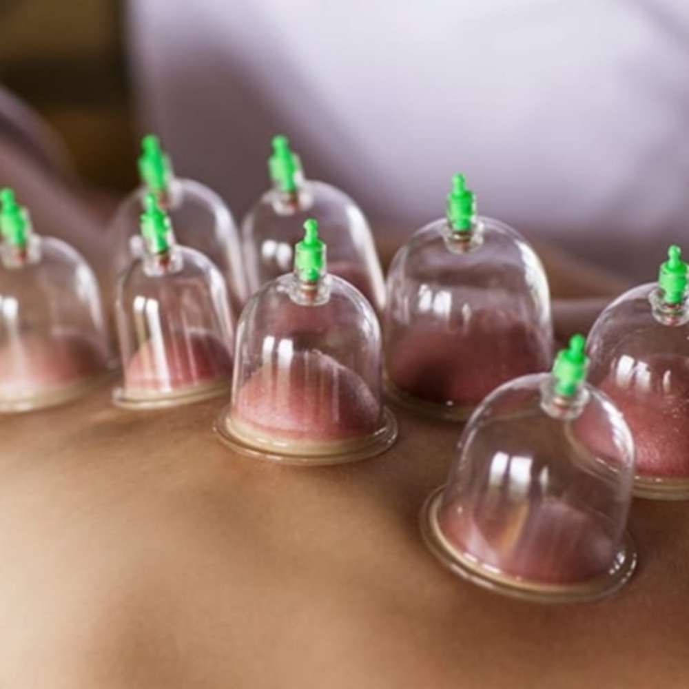 Cupping Therapy at Healing Touch Massage And Spa in New Albany, MS