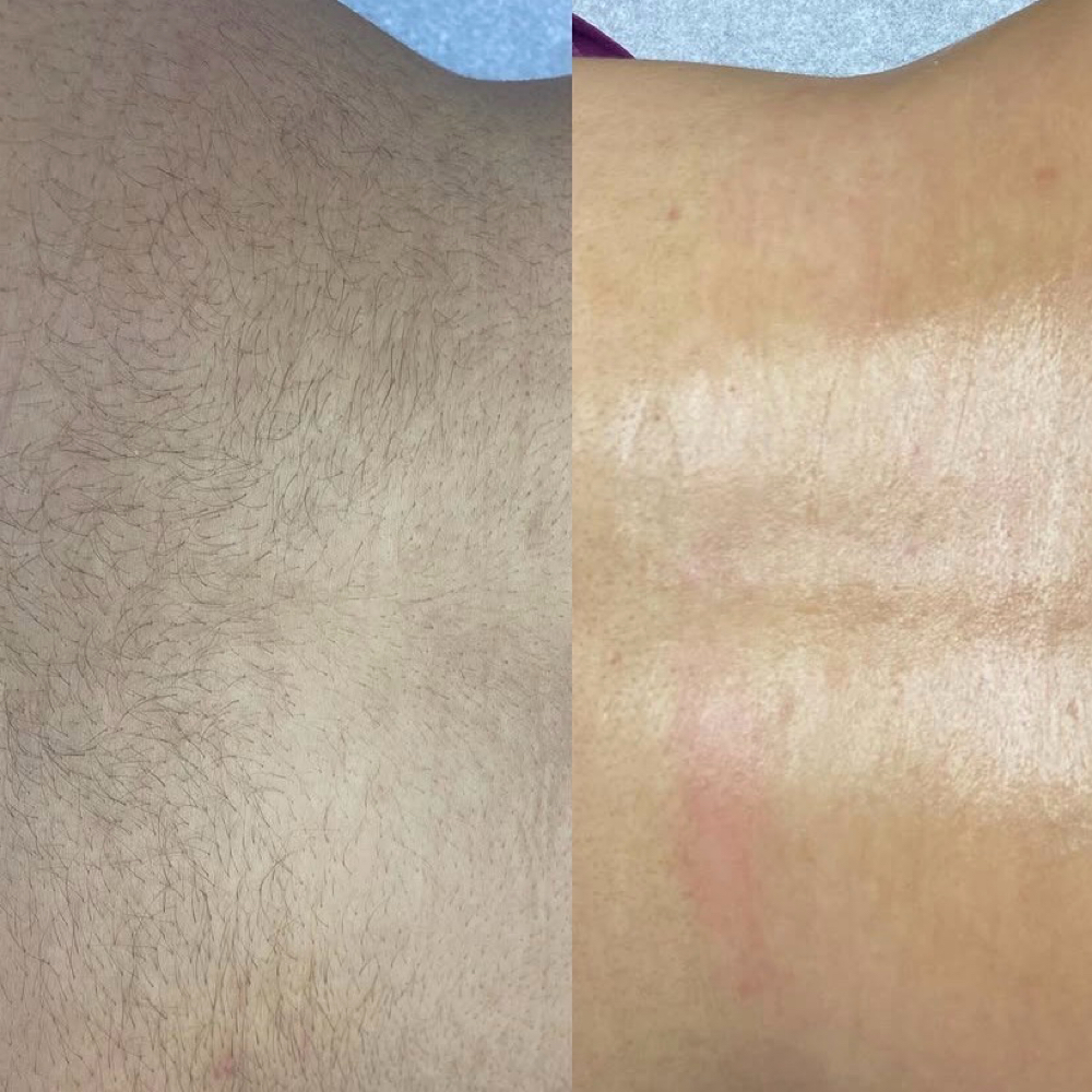 Lower Back Wax at Blush Hair & Beauty in harlingen, TX