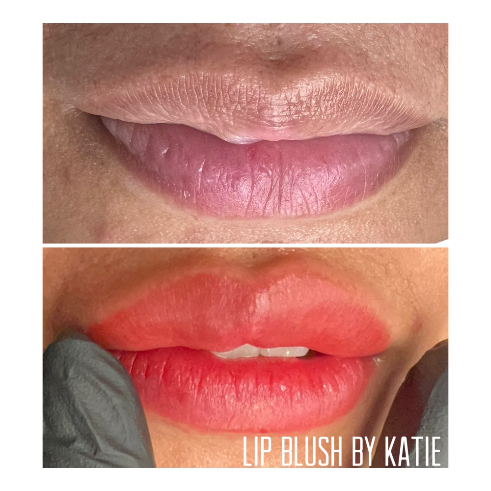 Lip With Correction