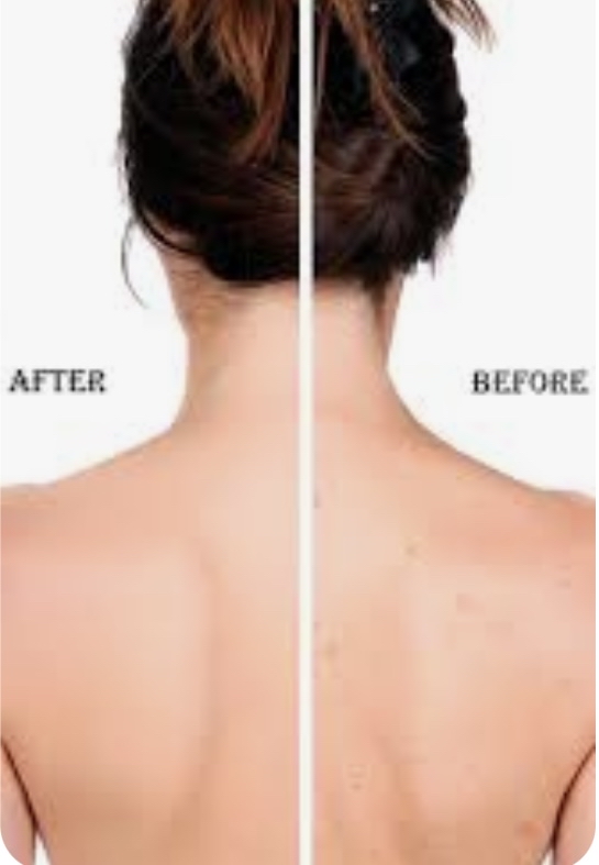 Back Facial