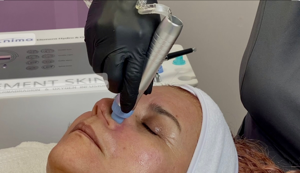 Hydrodermabrasion Pkg 3