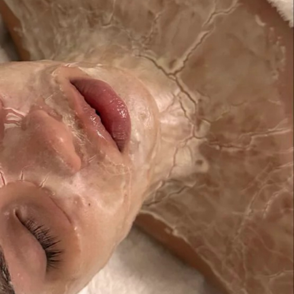 Microneedling face+neck And Chest at Lilian Oliveira Aesthetician in Malden, MA