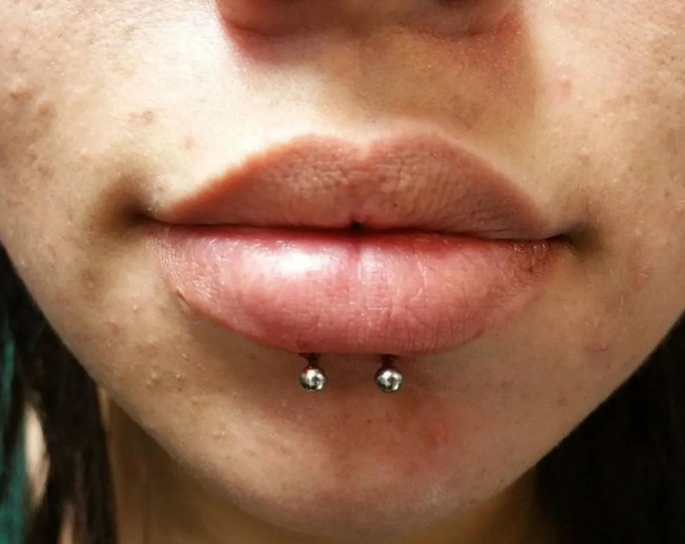 Lip (Double)