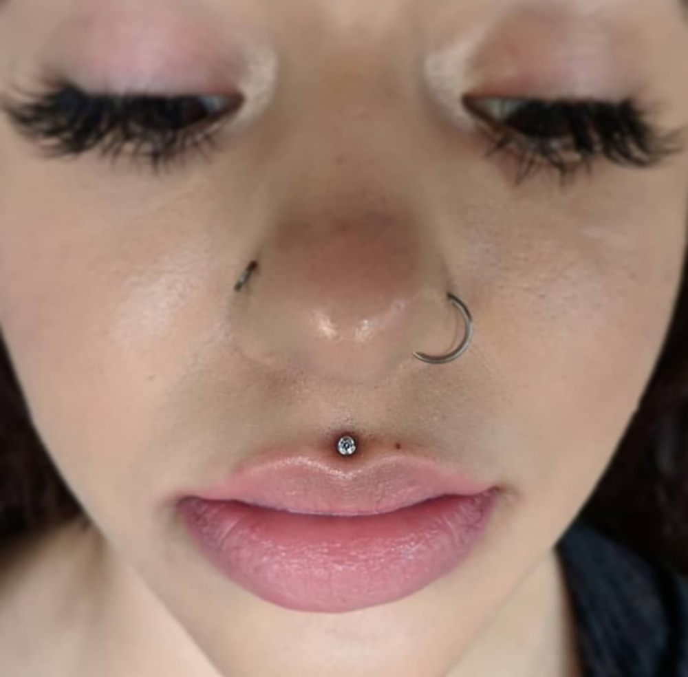 Philtrum (Medusa)