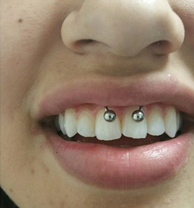 Smiley