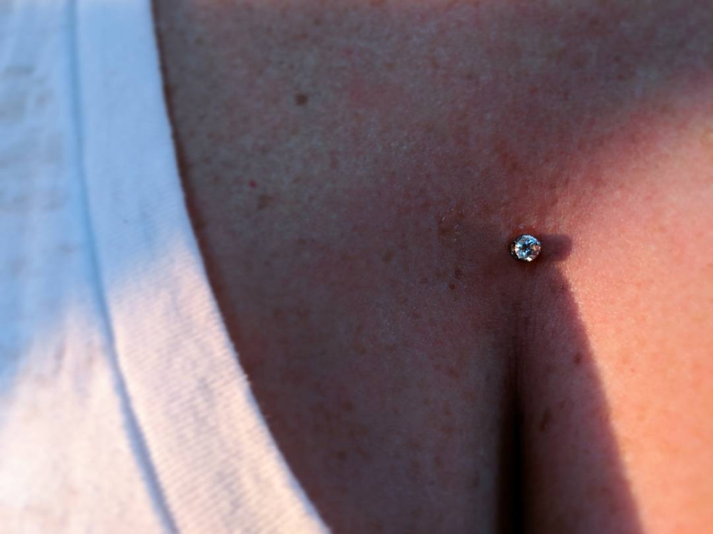 Dermal X2