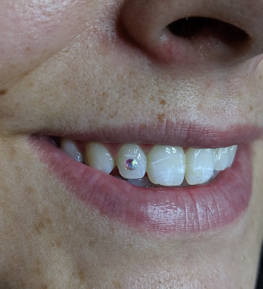 Tooth Gem (Single) at Pierced El Paso in El Paso, TX