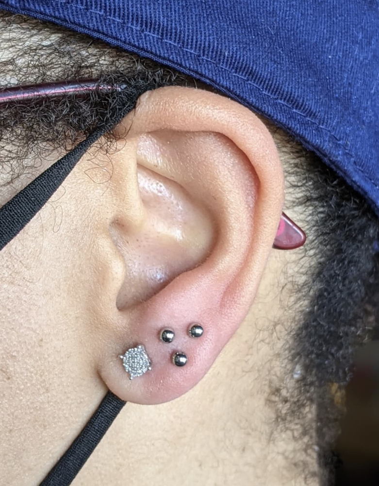 Lobe X3