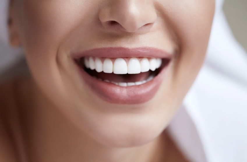 Teeth Whitening at Vluxe Studio in Newcastle, WA