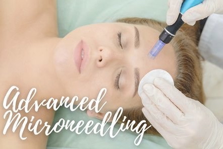 Microneedling Only Training