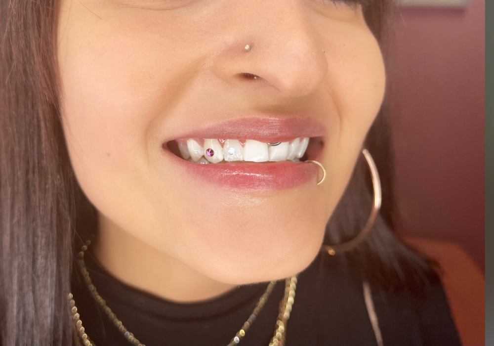 Tooth Gems