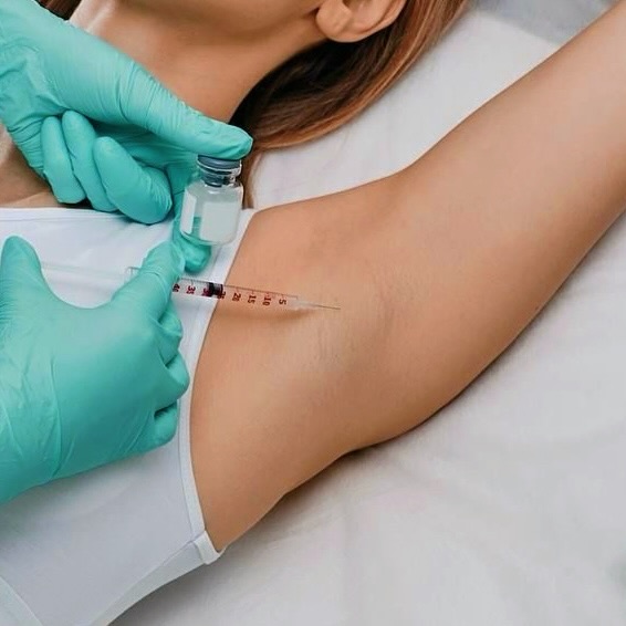 Hyperhidrosis Underarm Tox