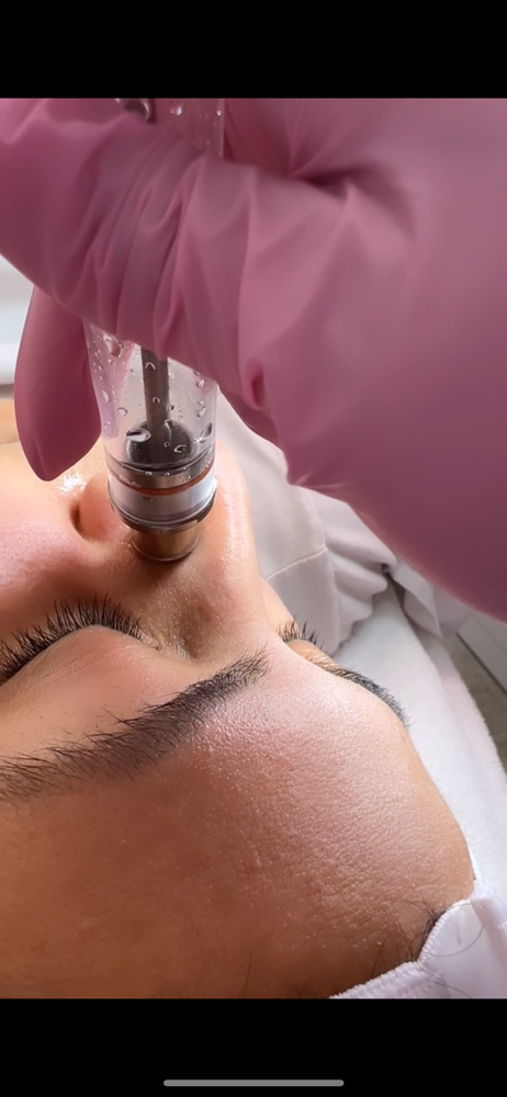 Hydrodermabrasion Facial at Jisell Aesthetics in Houston, TX