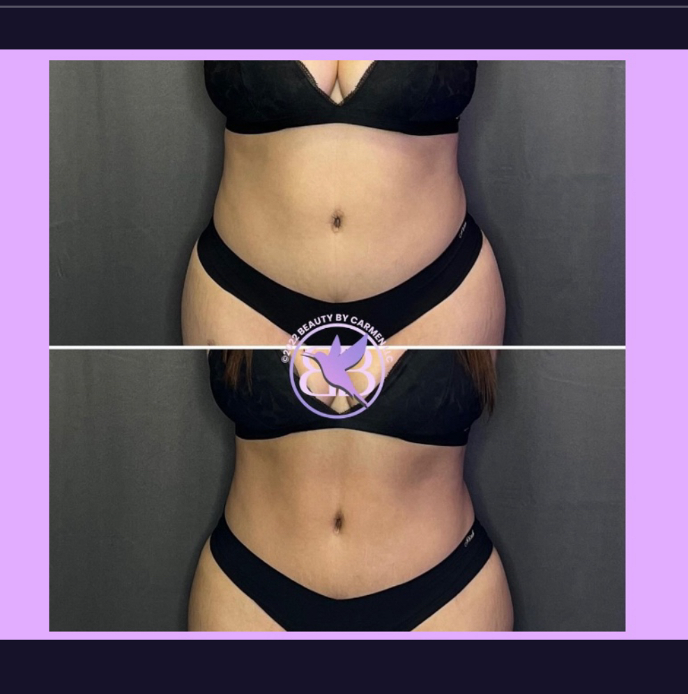 One Hour Body Sculpting