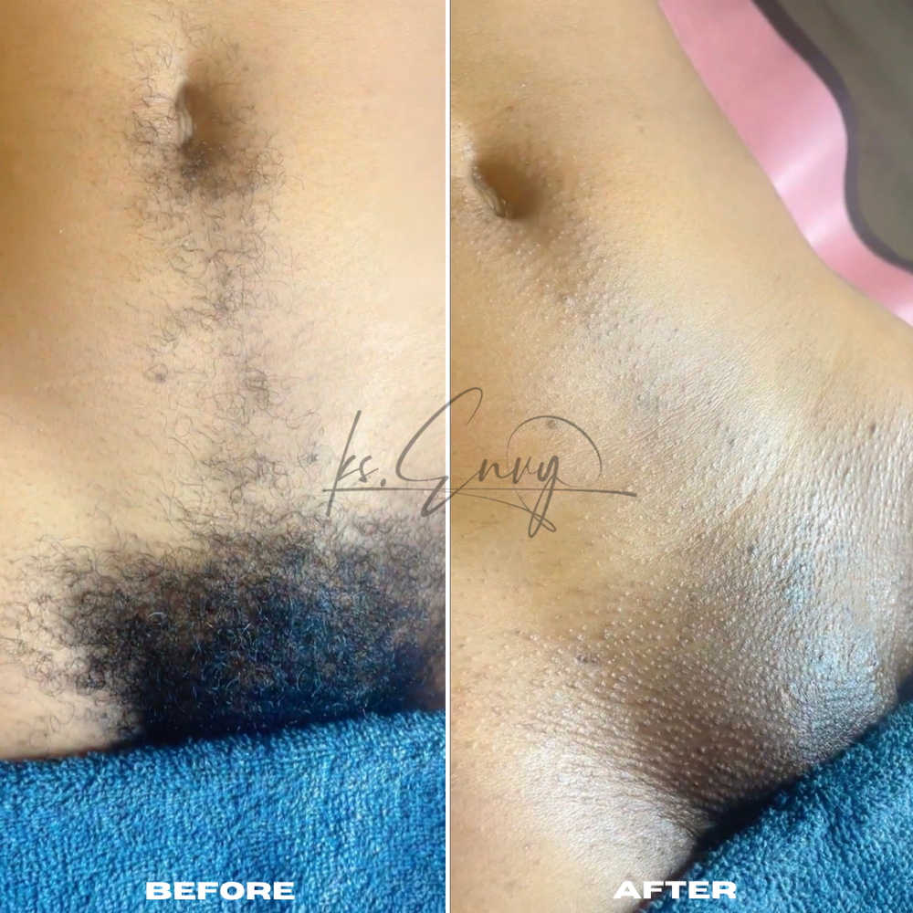 Brazilian Wax | The Silk Brazilian at KS.Envy in Columbus, OH