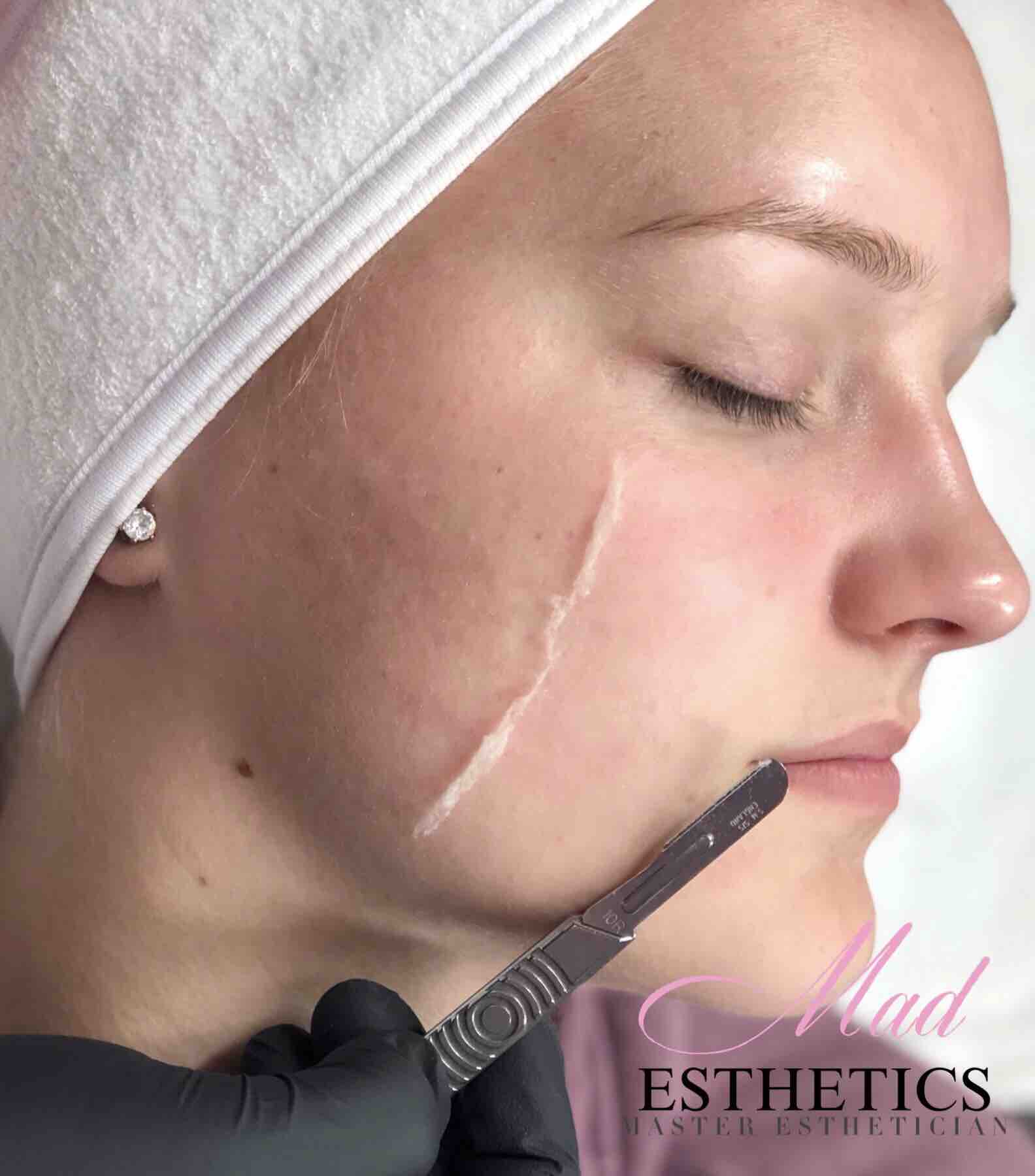 Deluxe Dermaplaning Treatment