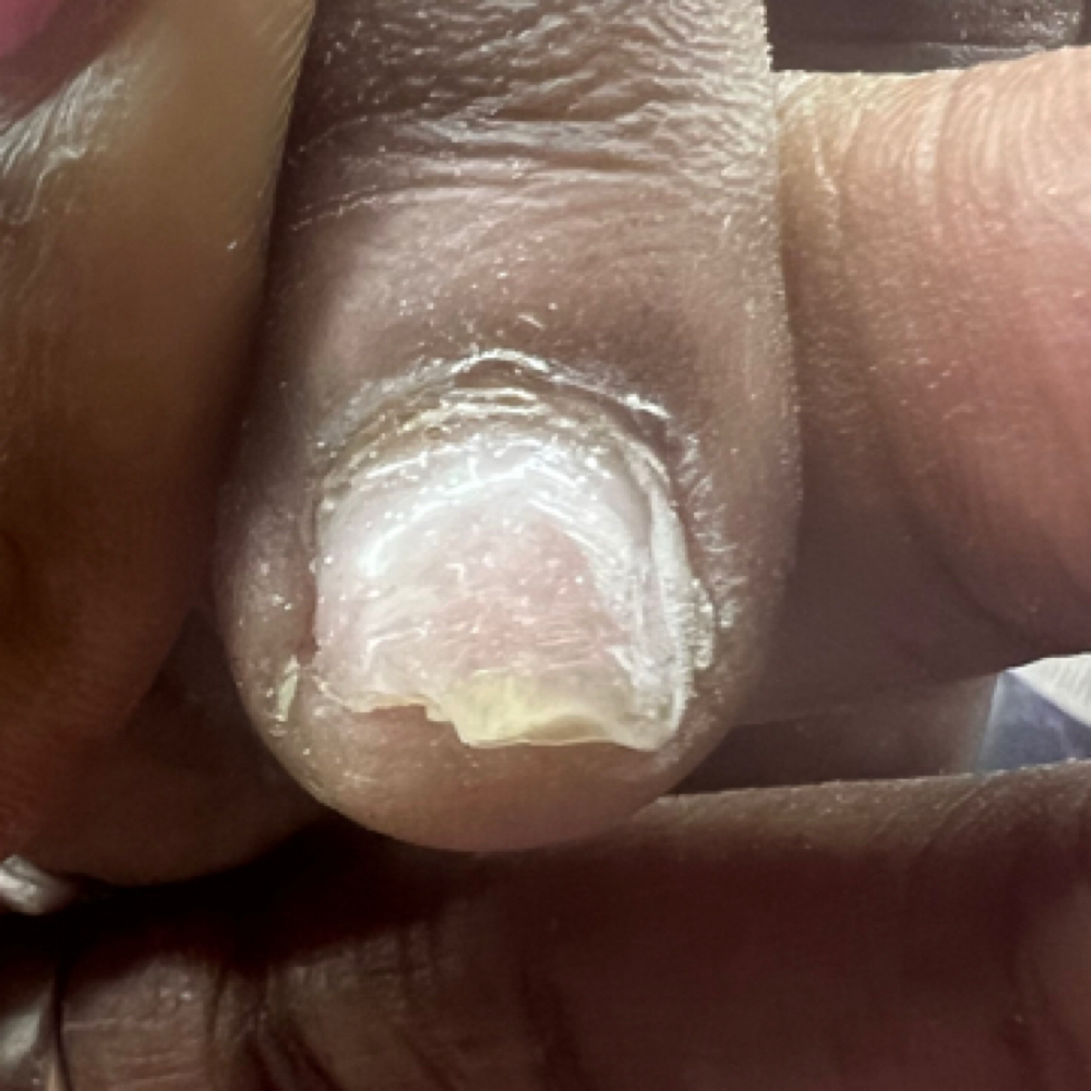 Nails Fixed at That 1  Nail Salon in Greenville, OH