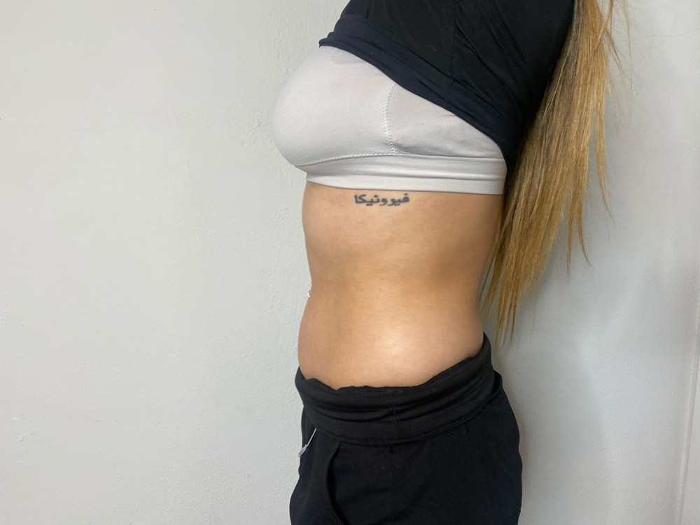 B.S. STOMACH