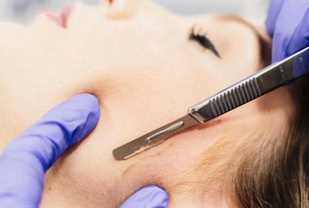 Add Dermaplane To Any Facial