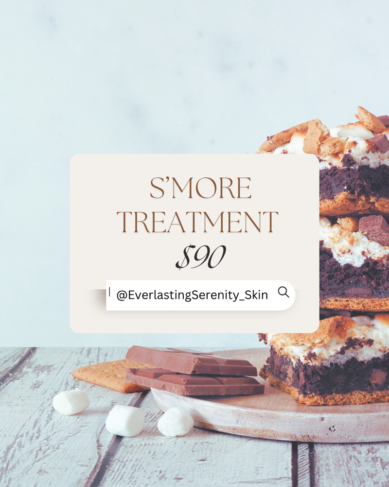 S’more Treatment