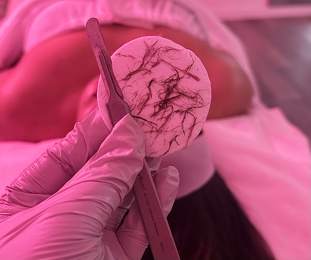 DERMAPLANE