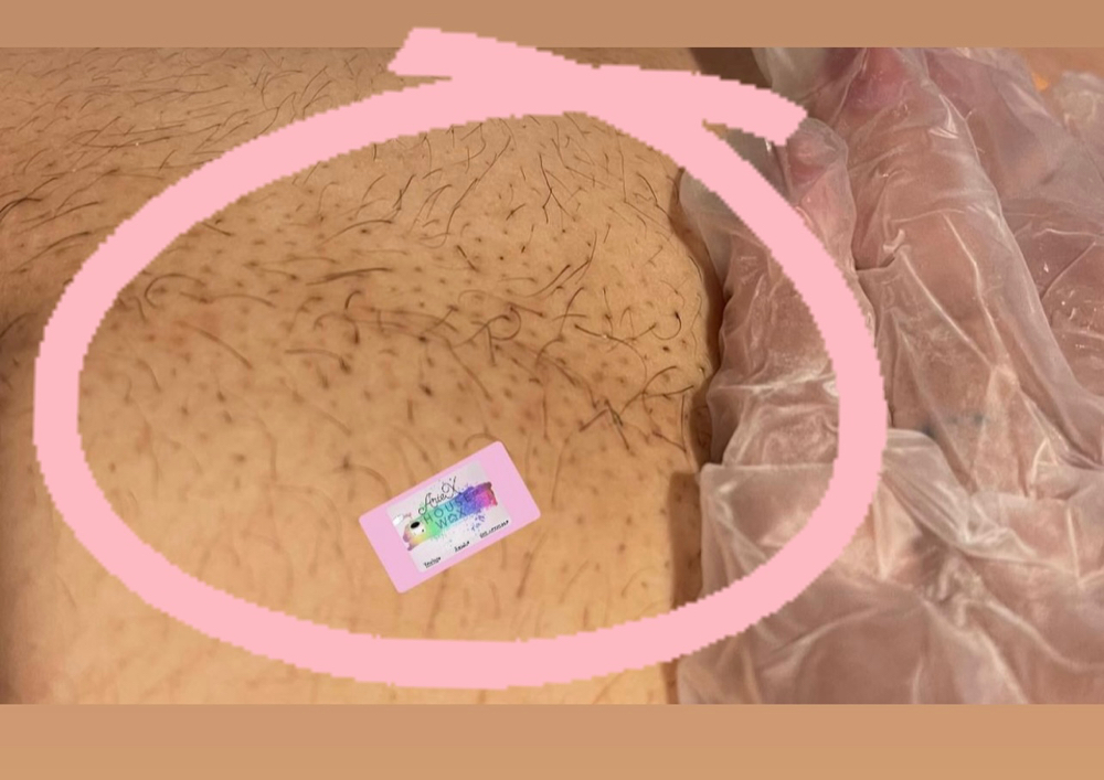 Lower Belly Strip