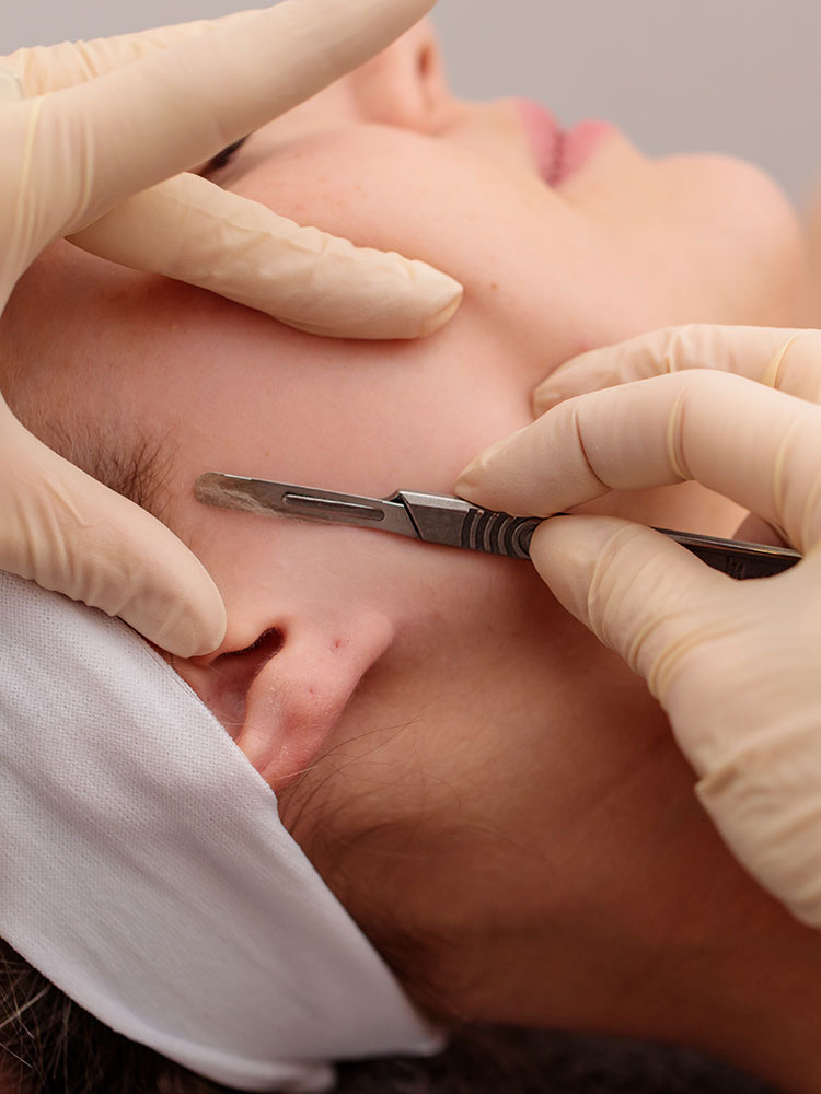 Dermaplaning Facial
