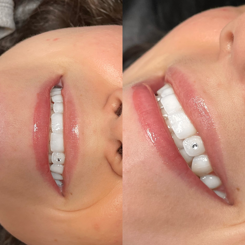 Tooth Gems π