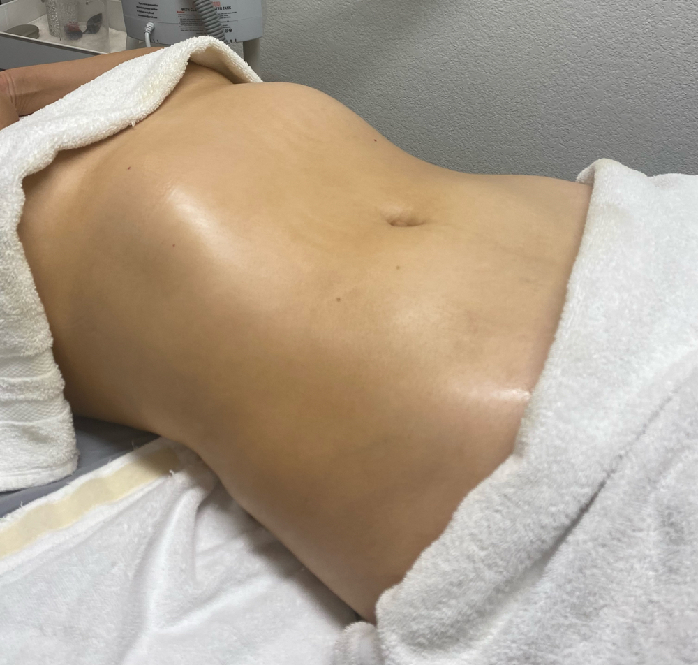 Lymphatic Drainage + Wood therapy