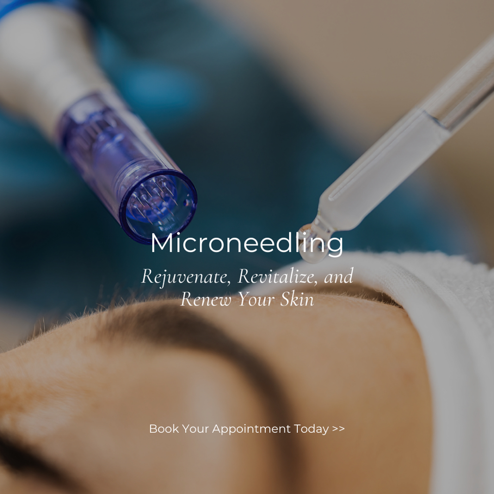Microneedling with hydrofacial at glowbync_threadingandfacials in Alpharetta, GA