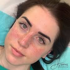PERMANENT FRECKLES