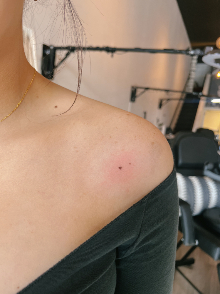 Freckle Hearts