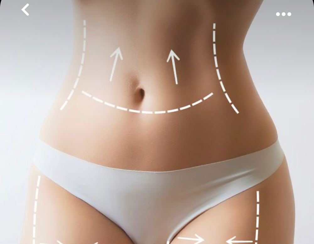Lymphatic Massage