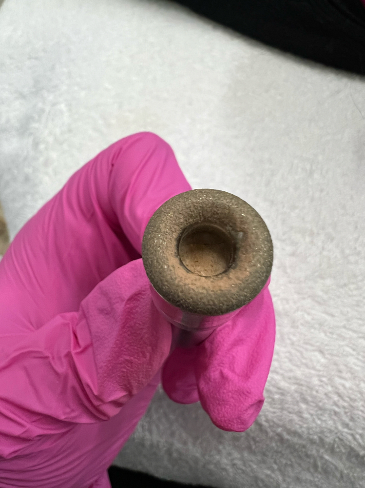 Microdermabrasion Facial at Jisell Aesthetics in Houston, TX