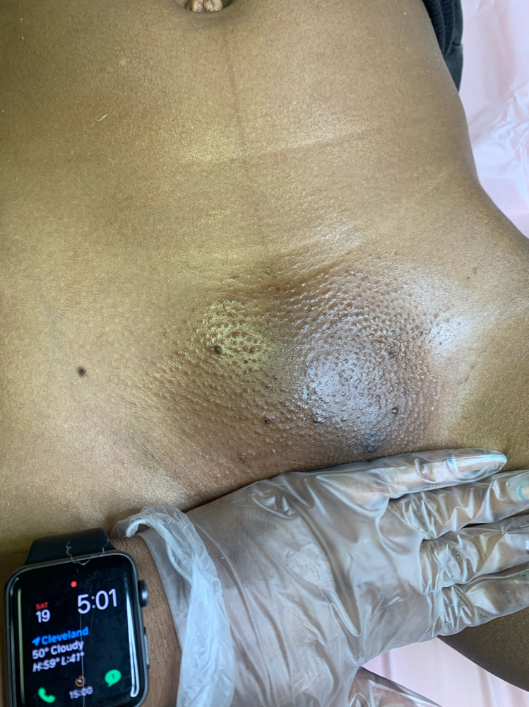 Brazilian Wax