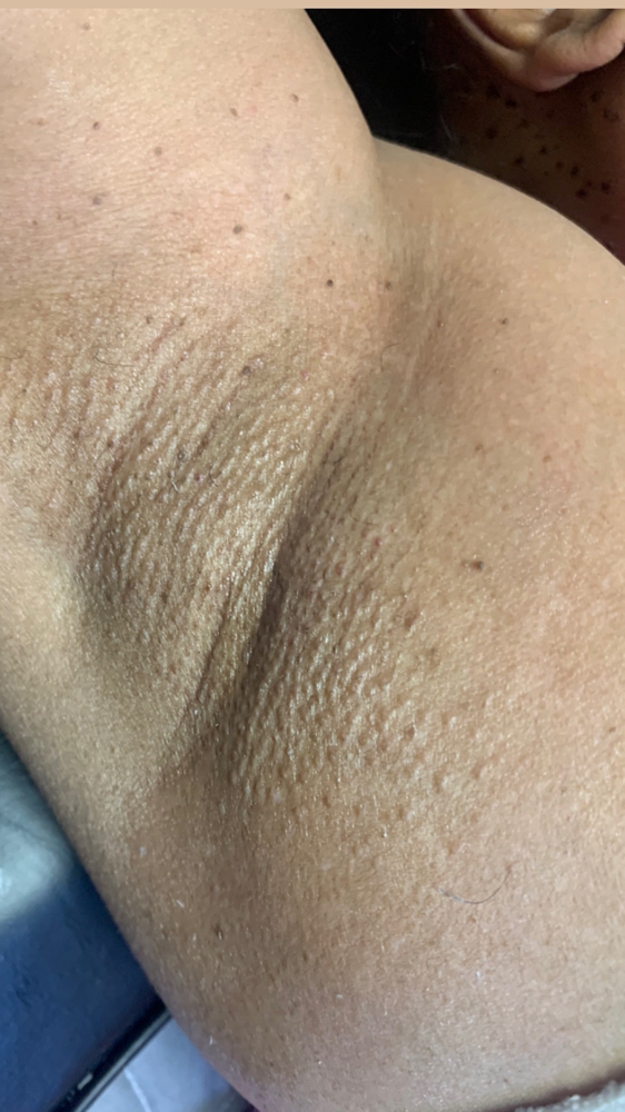 Underarm Wax