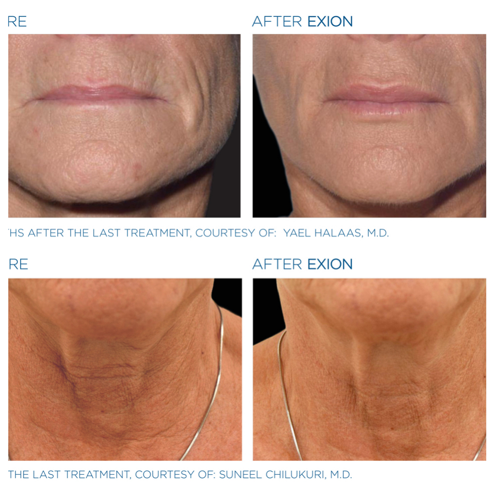 New Client — Skin Reset Assessment at Megalife Skin & Beauty in Tempe, AZ