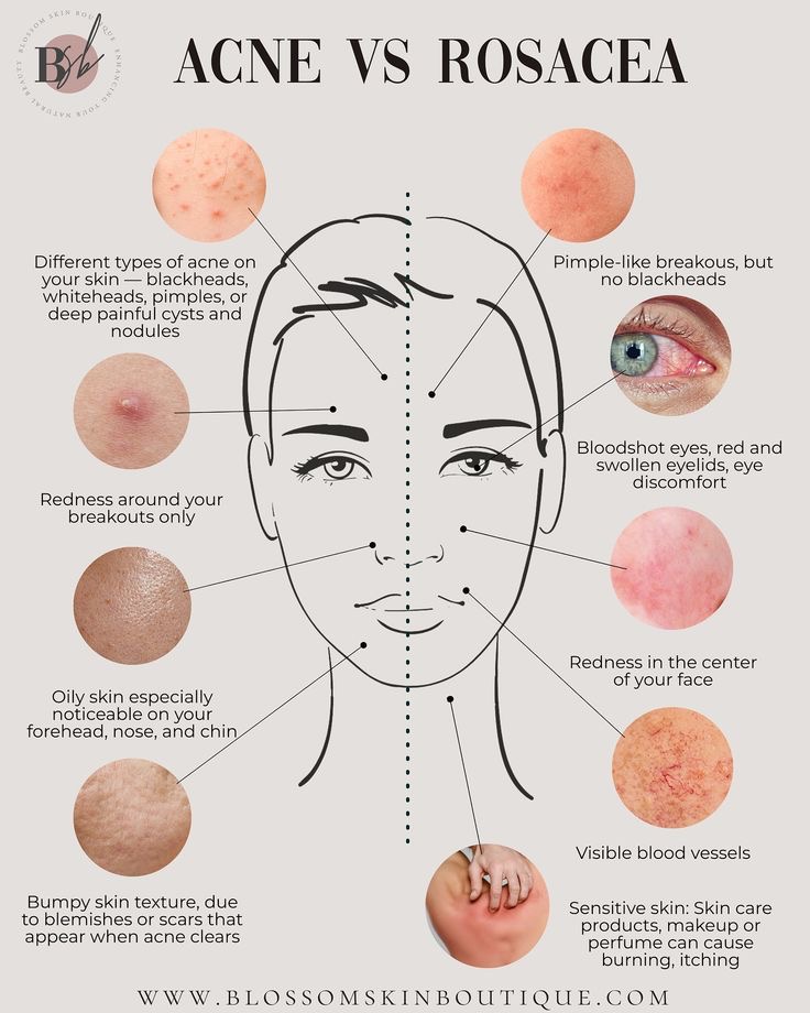 custom Facial at Reborn beauty spa in Beverly, MA